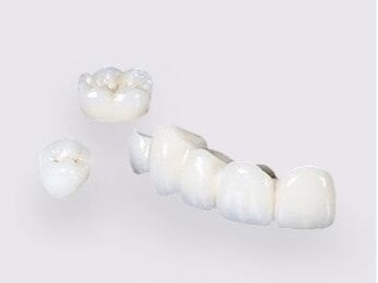 承德烤瓷牙選多少錢一顆的合適