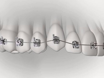 承德市哪家口腔醫(yī)院口腔正畸做得好？惟德口腔醫(yī)院來告訴您