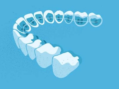 惟德口腔醫(yī)院口腔正畸好不好？