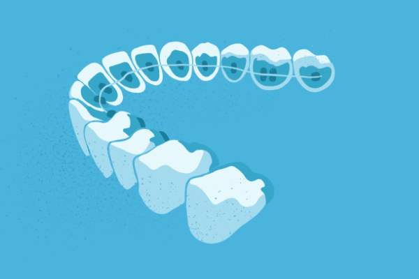 惟德口腔醫(yī)院口腔正畸好不好？